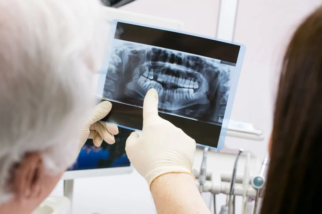 examen dental en cancun